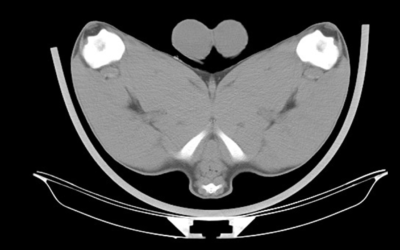 Computer tomography (CT) scanning enhances terminal sire selection and flock performance